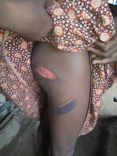 Wickedness! Lady Burns Her Maids' Buttocks With Iron