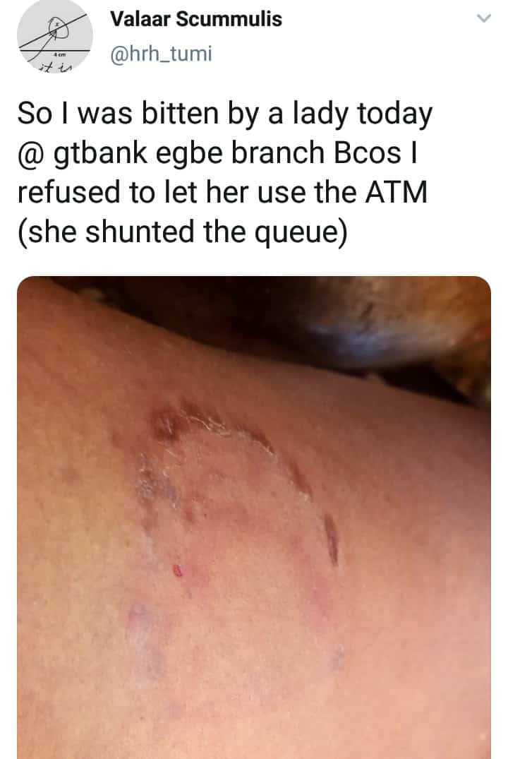 Female Bank Customer Allegedly Bites Man (Photos)