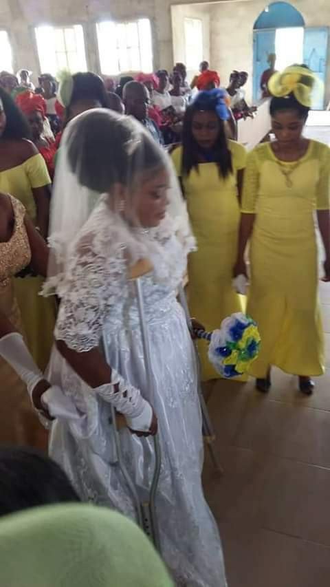 Woman Walks Down The Aisle On Crutches After She Survived Fatal Accident (Photos)