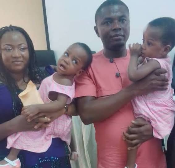 First Separation Of Conjoined Twins Recorded At National Hospital Abuja (Photo)