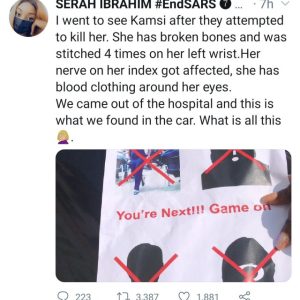 Lady Who Visited Brutalized EndSARS Protester In Hospital Shares Life-Threatening Note She Found On Her Car.