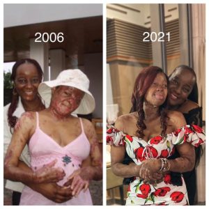To Celebrate Her Mother, Kechi Shares Photo Taken One Year After Surviving Plane Crash